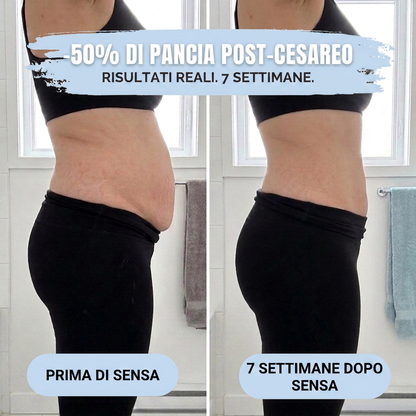 VitaShape™ - Slip Post-Parto a Compressione 360°